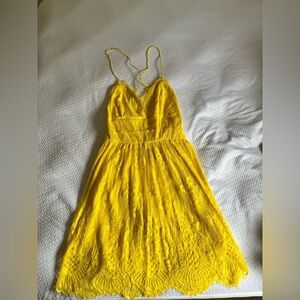 Women’s Yellow Lace Dress